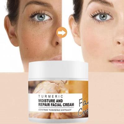 Turmeric Facial Skin Repair Cream Acne Treatment Face Moisturizer Whitening Lightening Against Acne Remover Cream