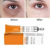 Vitamin C Brightening Eye Serum For Dark Circles Puffiness And Fine Lines In 20ml