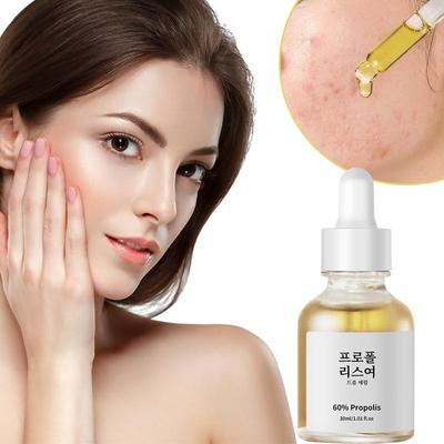 Propolis Akne-Essenz, feuchtigkeitsspendend, verbessert Akne, kontrolliert Öl und verengt die Poren, Hautpflege-Gesichtsserum