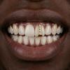 Gold & Diamond Hip Hop Single Tooth Gap Grill for Men & Women - Smooth Halloween Dental Accessory