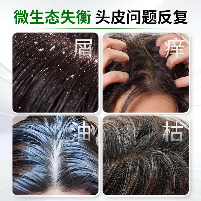 Beijing Tongrentang Selenium Disulfide dandruff shampoo, oil control, fluffiness, anti itch shampoo cream, dandruff shampoo