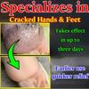 Krém na popraskané nohy, omrzliny pat, suché praskání, praskání, praskání, plísňová infekce, praskliny na rukou a nohou [Speciální pro suché ruce a nohy]