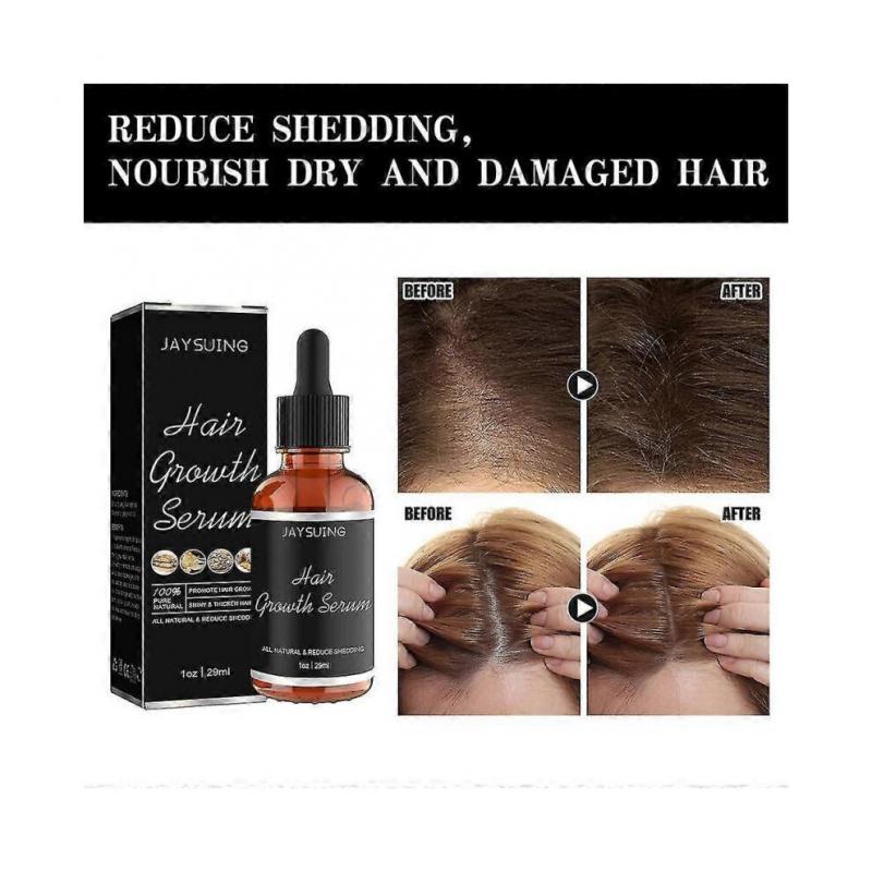 3pcs Noor Hair Growth Serum African Olives, Noor Love Hair Growth Serum