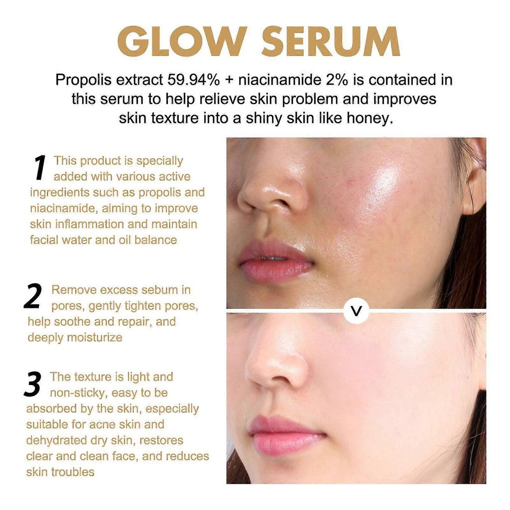 Eelhoe Propolis Niacinamide Light-Sensing Serum For Fading Acne Marks, Hydrating, And Brightening The Face