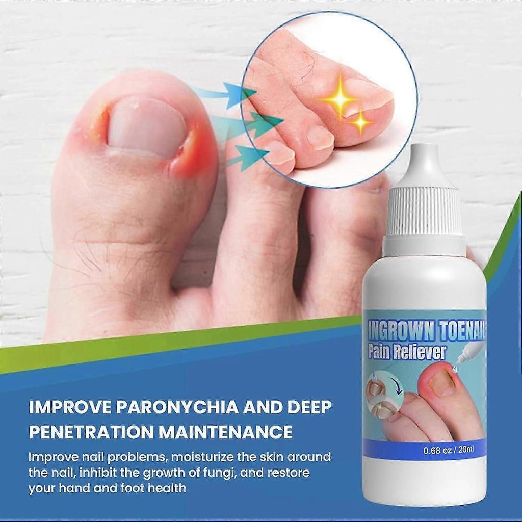 Ingrown Toenail Treatment Extra Strong,Ingrown Toenail Drop,Cuticle Care Oil for Ingrown Toenails Ingrown Toenail Tools