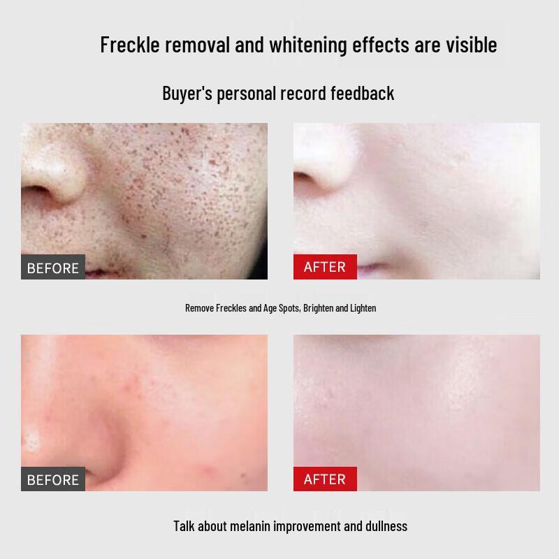 Jingliyan Spot & Tone Correcting Skincare