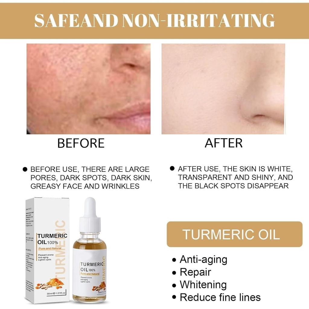 Turmeric Dark Spot Corrector Serum, Natural Turmeric Dark Spot Corrector Serum for Face, Skin Care Moisturizing Serum, Formulated with hyaluronic acid