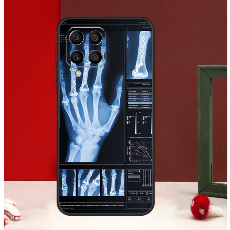 

Radiological Human Organs Skeleton Case For Samsung Galaxy M56 M36 M16 M31 M21 M13 M33 M53 M15 M35 M55 M12 M32 M52 M14 M34 M54 For Samsung M56