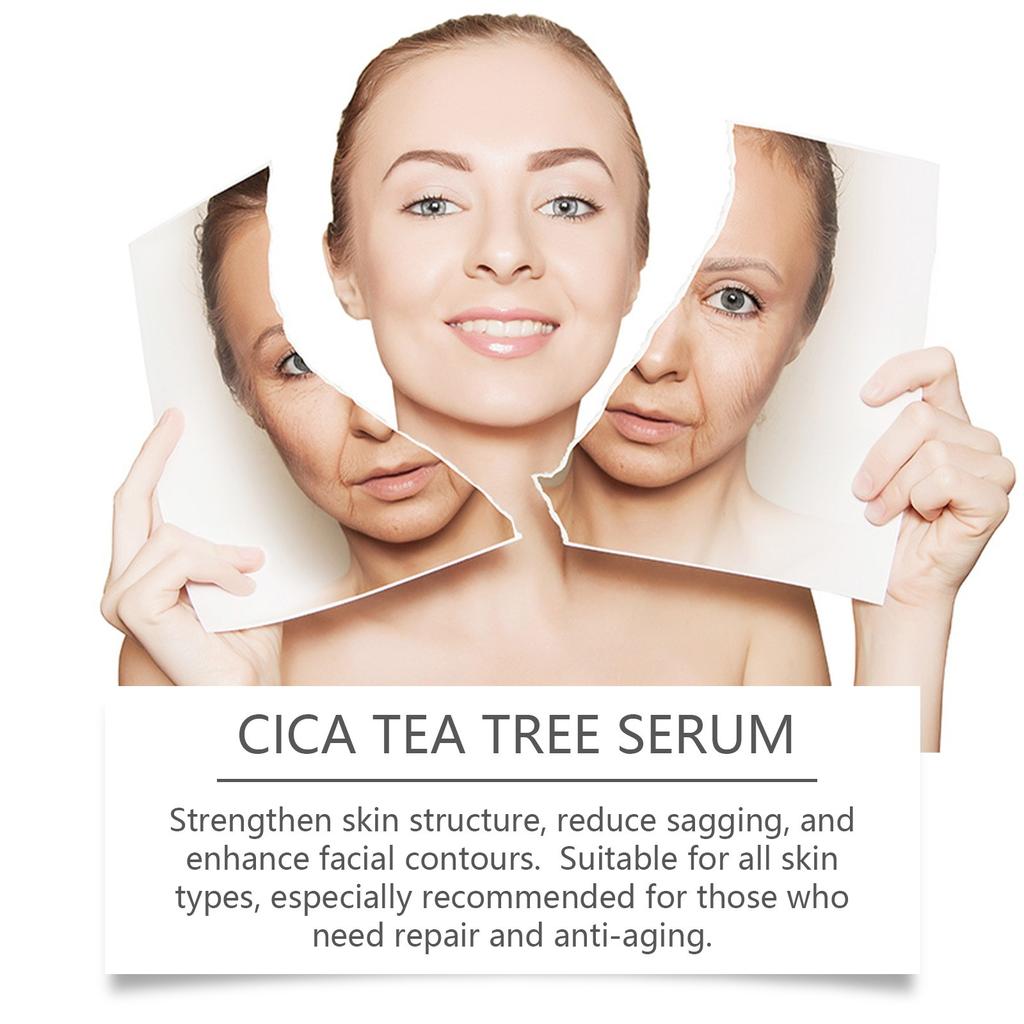 Centella Asiatica Serum Moisturizing And Nourishing Skin Facial Brightening Skin Care Serum 30ml