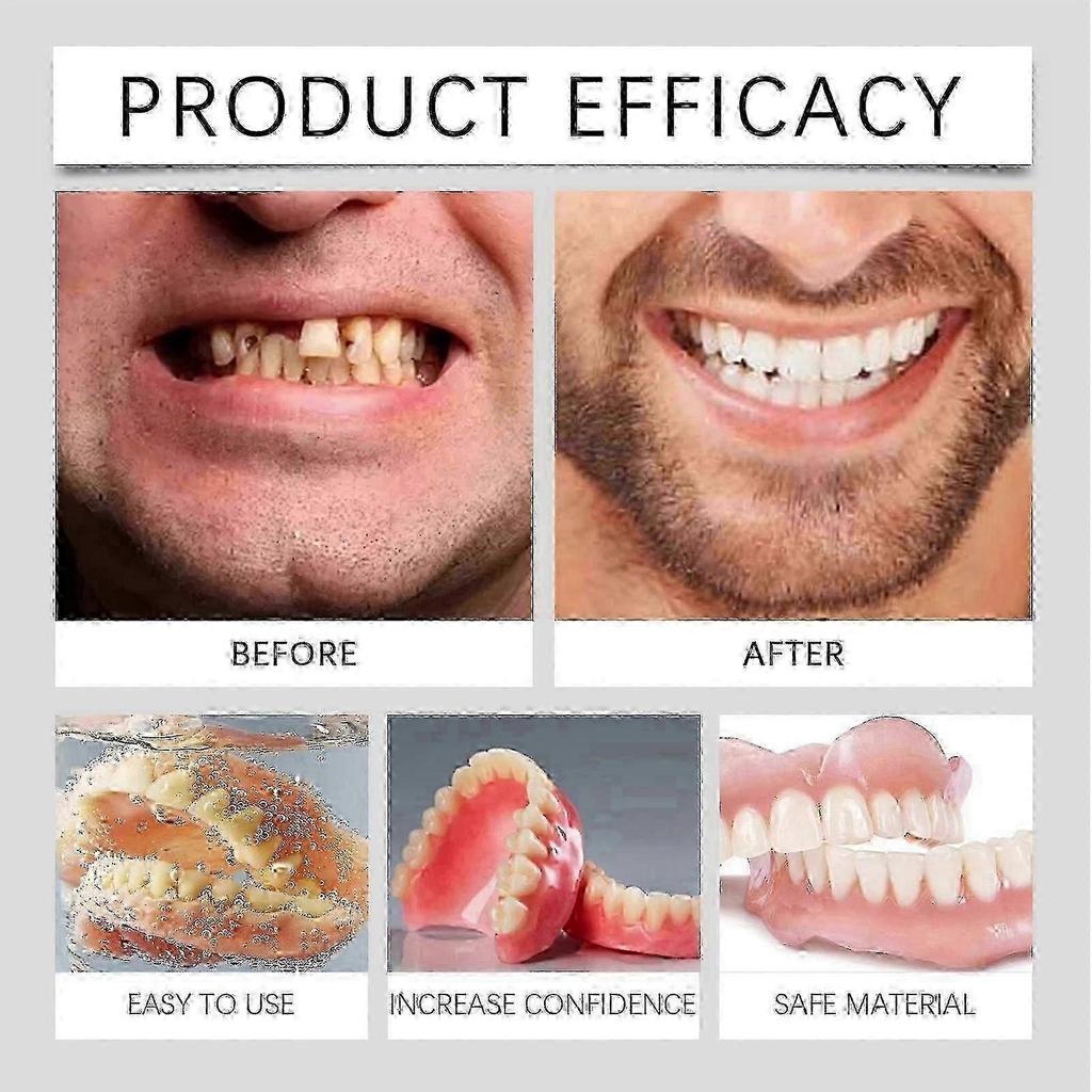2026 Best!! Full Denture Set, Upper and Lower False Teeth for Men Women, Perfect Fit