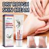 Ximonth Foot Care Cream Enriched Moisturizing Relief For Dry Cracked Heels And Skin