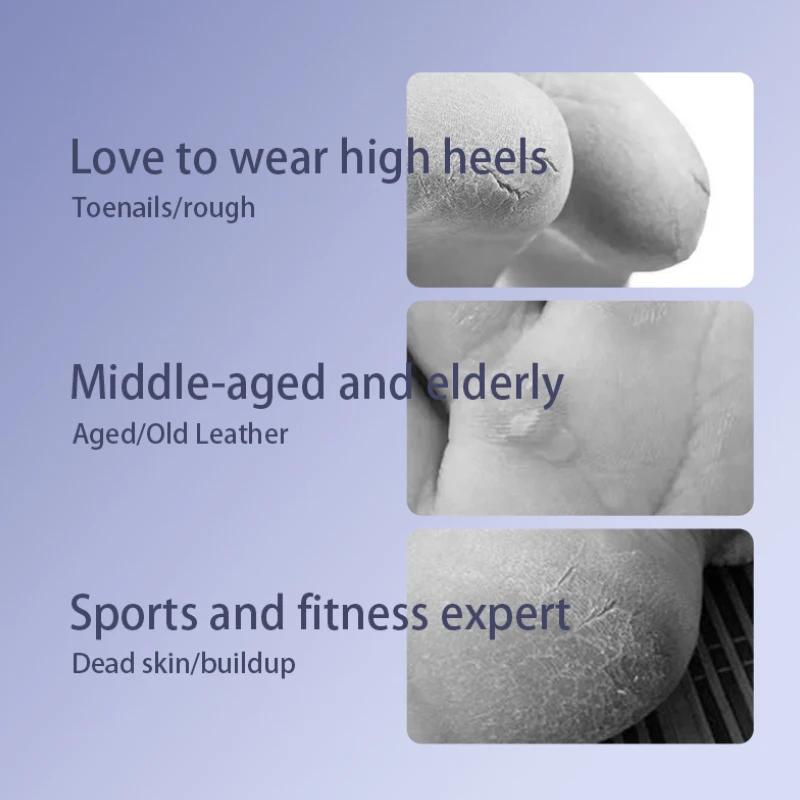 Elektrische Pediküre Fußfeile IPX6-Wasserdicht Fußschönheitsgerät Pediküre-Maschine Wiederaufladbar Entfernt Tote Haut & Hornhaut des Körpers