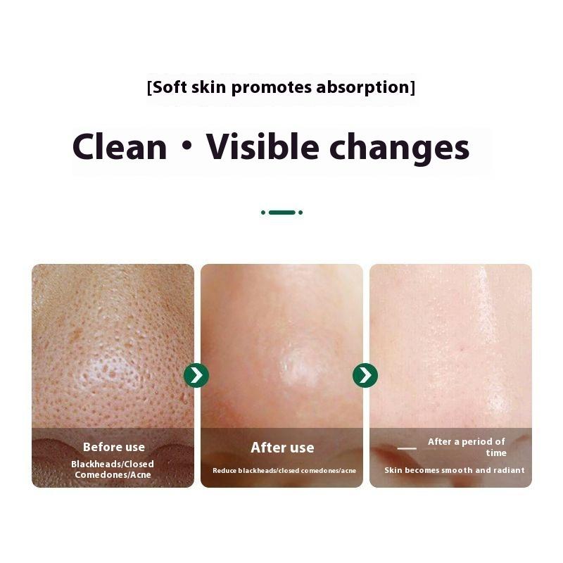 Ice Crystal Cleansing Gel Cleansing Cream for Face Blackening Discharge Black Toxins Blackhead Acne Shrinking Pores for Beauty