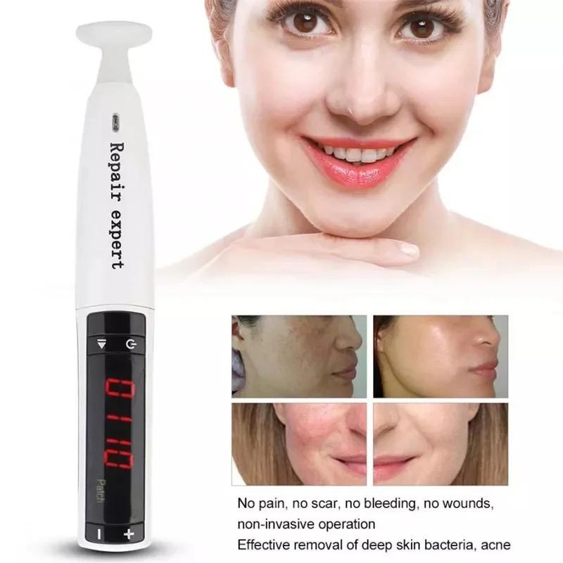 Rivitalizza la Tua Pelle Con la Penna al Plasma Ozono Per il Trattamento dell'Acne, Ringiovanimento Cutaneo, Riduzione delle Cicatrici, Rassodamento della Pelle