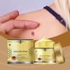 Verruca Care Cream Gentle Cleansing, Moisturizing And Softening The Skin, Reducing Skin Discomfort.