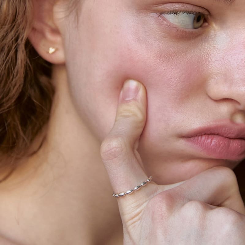 Soybean Ring mimesis