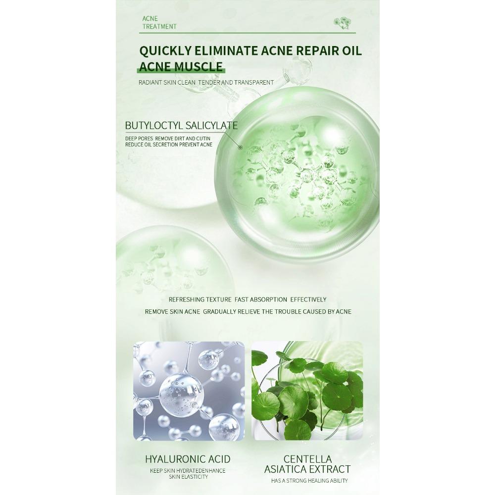 Centella Asiais Acne Cream