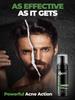 Beardo Acne Clear Foam Face Wash 100ml Pack of 1 | 3-in-1 Anti Acne Face Wash for Men with Salicylic Acid
