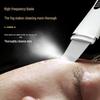 Ultrasonic Facial Cleanser & Blackhead Remover 