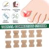 Autocollants de correction d'ongle incarné pour les mains et les pieds, incrustations d'ongles souples, épaississement des ongles, sillons brillants, patch de soin des ongles gris, 50 pièces