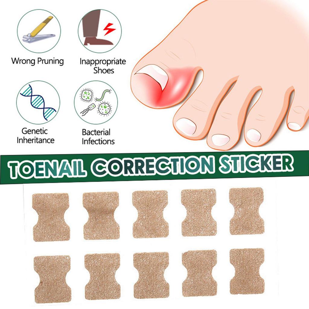 Aufkleber zur Korrektur eingewachsener Zehennägel für Hände und Füße, weicher Nagel, eingelegte Nagelverdickung, helle Nagelfurche, graues Nagelpflegepflaster, 50 Stück