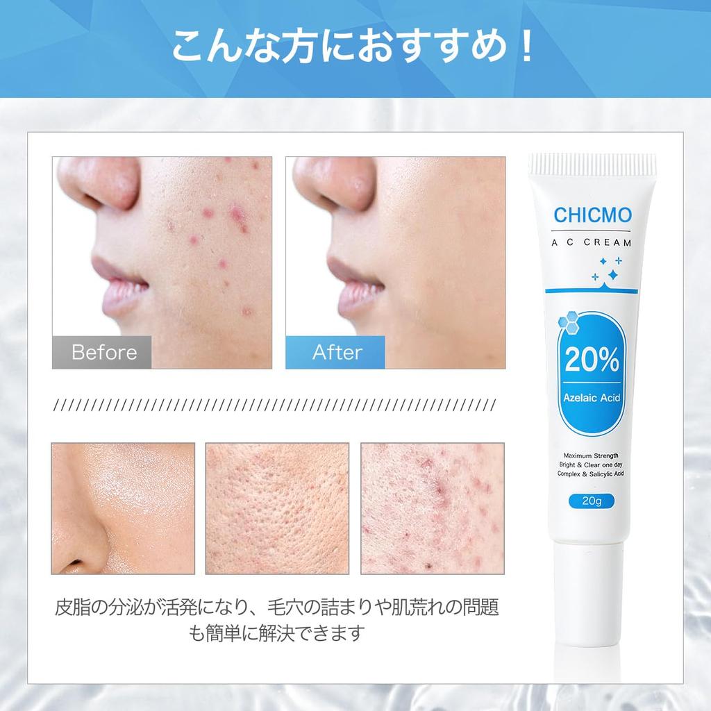 CICA AC Cream 20g with Azelaic High Concentration Salicylic Dipotassium Skin Care 20% Acid, Acid, Glycyrrhizate,