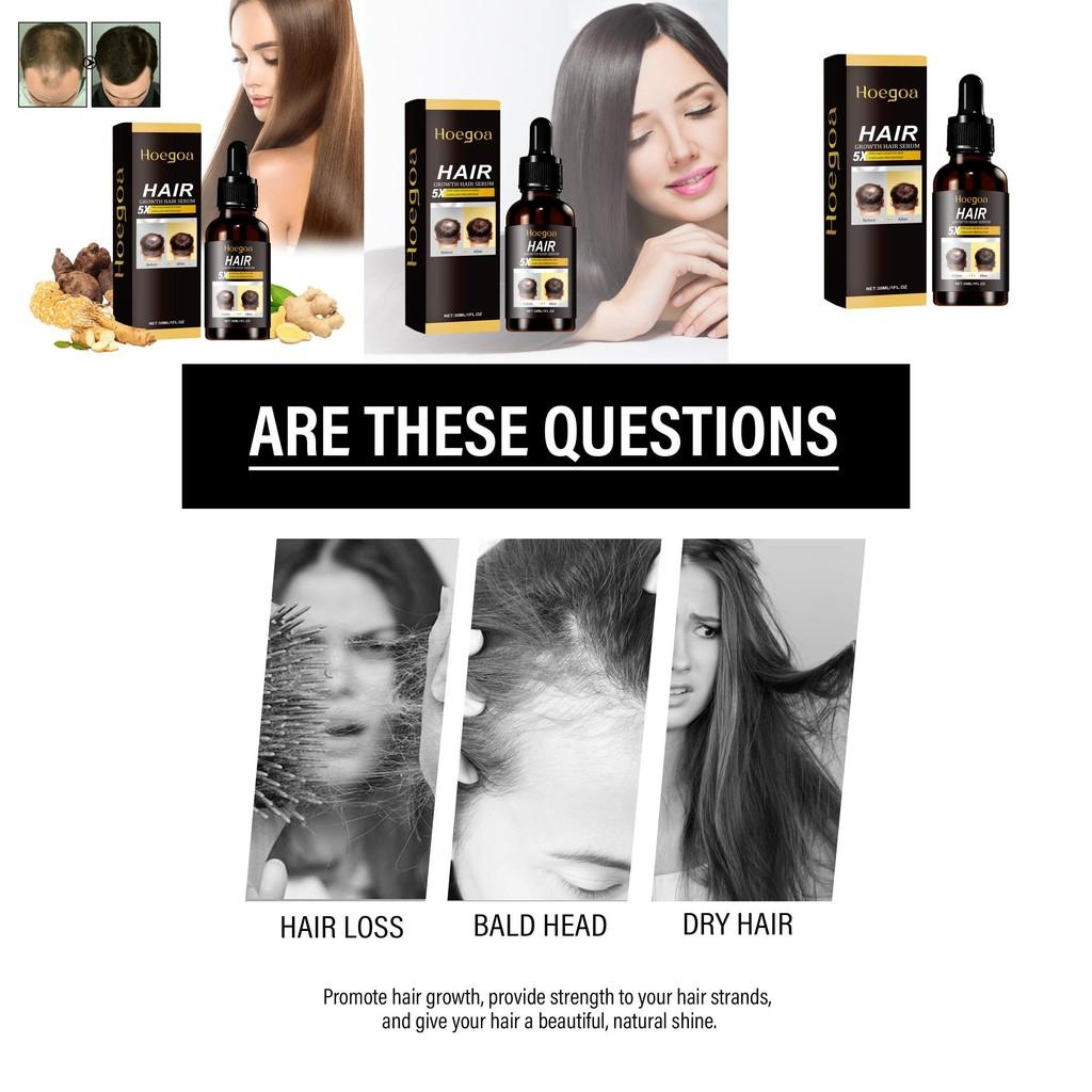 Hoegoa Ginger Infused Hair Essence For Revitalizing Dry Frizzy And Damaged Hair