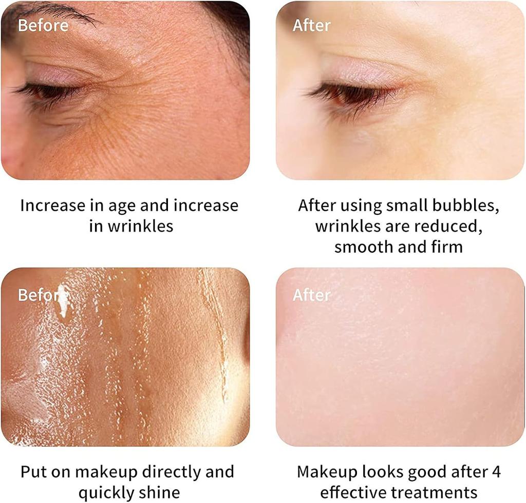 8 i 1 multifunksjonell hydrogen oksygenboble Ansiktsskjønnhetsmaskin Ansikt Hudforyngelse Fuktighetsgivende Anti Rynke Anti Aldring