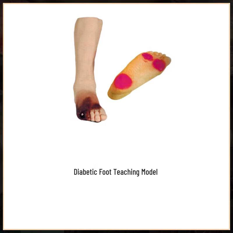 Diabetic Foot and Leg Ulcer Teaching Model