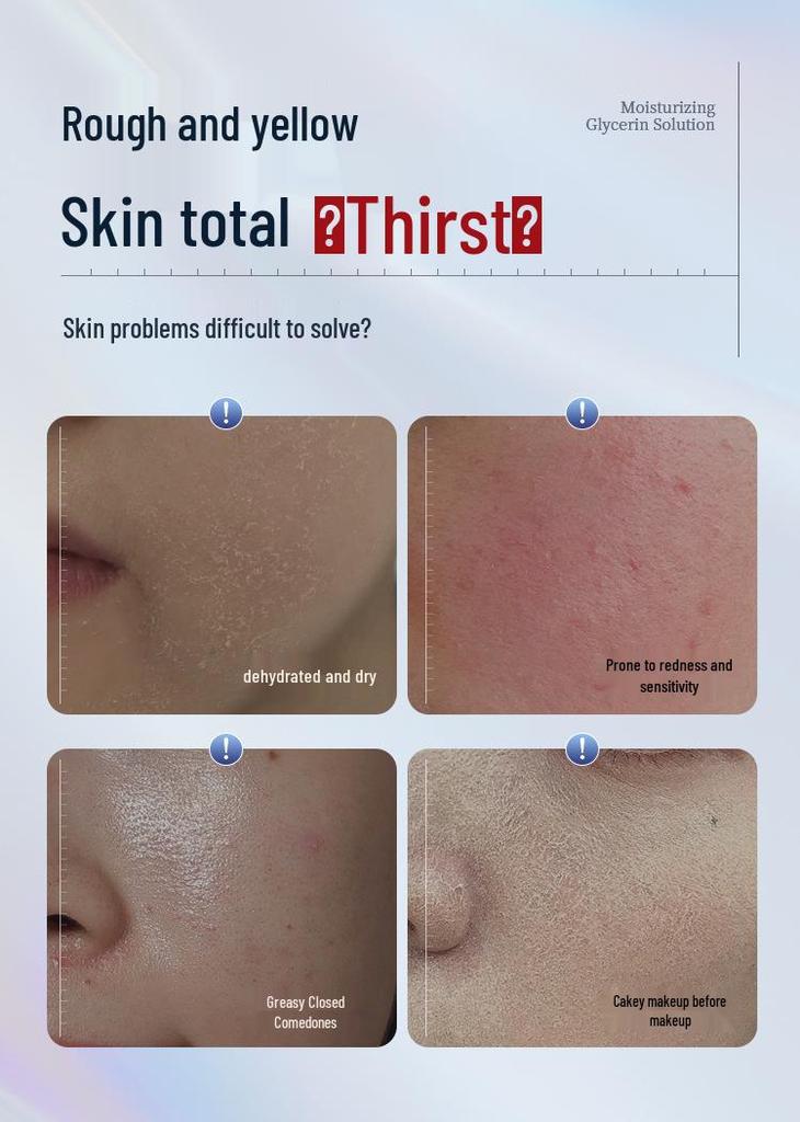NHA Vitamin E Brightening Niacinamide Essence - Moisturizing Liquid for Dull Skin