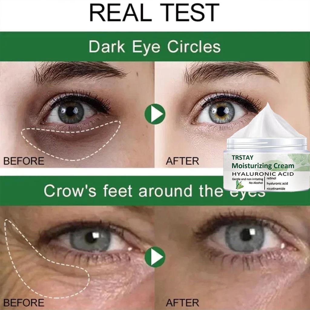 Skånsom og ikke-irriterende, Retinol Peptide Rejuvenating Moisturizing Eye Cream oppstrammer og lysner opp huden, og etterlater huden myk og raffinert