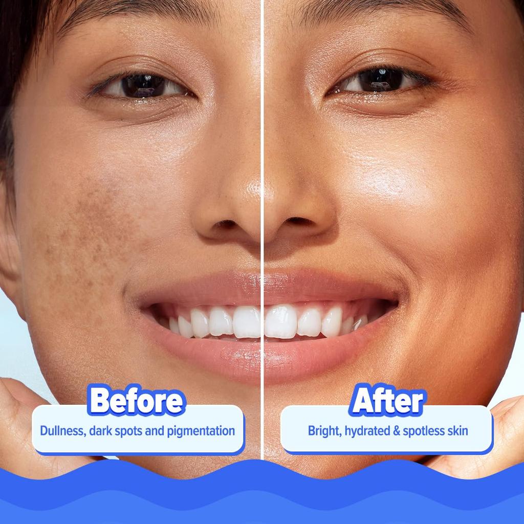 Aqualogica Bright+ Hydra Gel Moisturizer 200 g Pack Of 1 For 24-Hour Hydration & Bright Skin