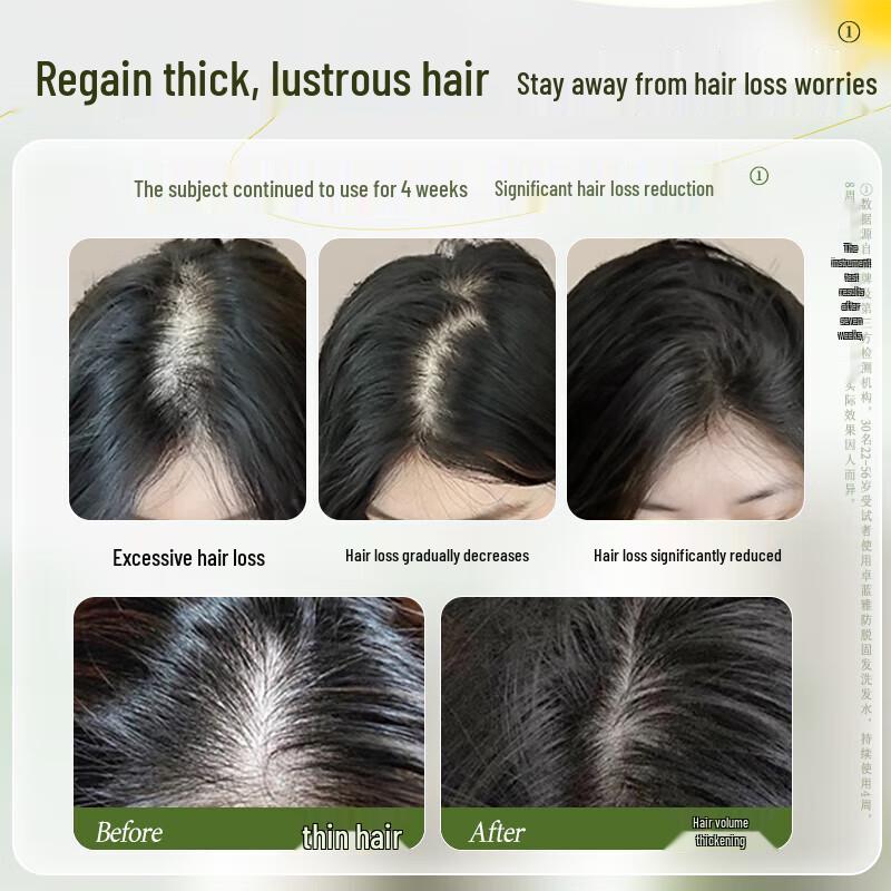 ZHUOLANYA Ginger Anti-Hair Loss Hair Care Set