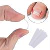 Curved Toenail Corrector Clips for Paronychia, 10Pcs for Ingrown Thick Nails
