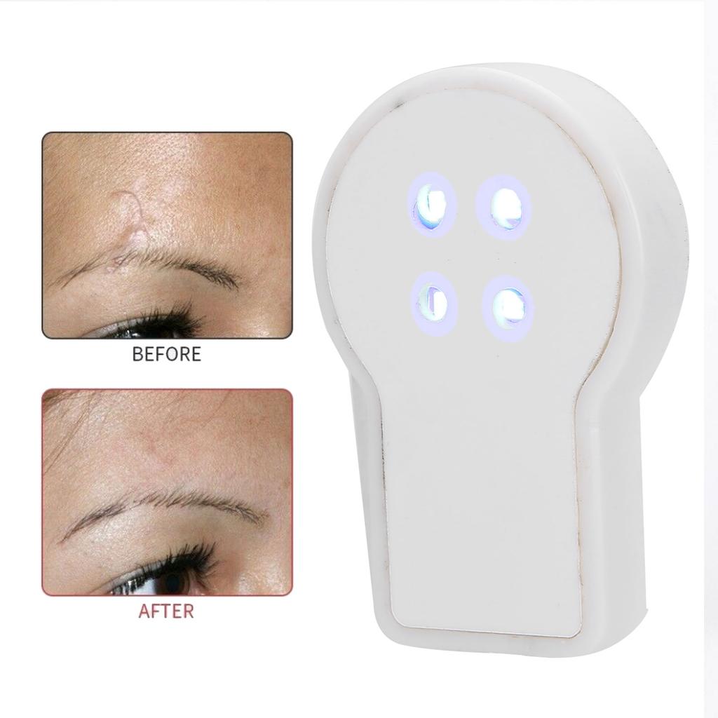USB Plug In Mini Handheld Acne Removal Machine Blue Light Therapy Acne Treatment Device
