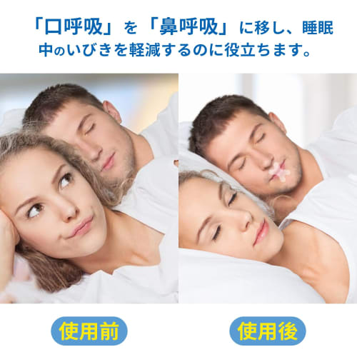 Yyciel 240-Count Mouth Closure Tape, Anti-Snoring Device, Mouth Breathing Prevention Tape, Reduces Mouth Breathing and Improves Nighttime Sleep, Anti-