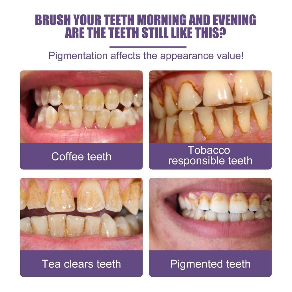 Oralhoe Purple Teeth Cleaning Powder Fresh Breath Tartar Calculus White Teeth Cleaning Scaling Powder Oral Care