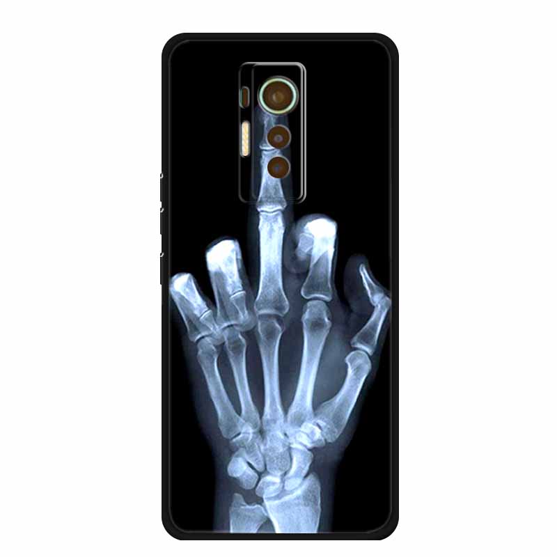 For Tecno Phantom X 2021 Case Animals TPU Silicone Soft Phone Cover Cases for PhantomX 2021 AC8 Protective Shockproof Wolf Shell