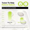 Anua - Ultra-Thin Spot Cover Patch