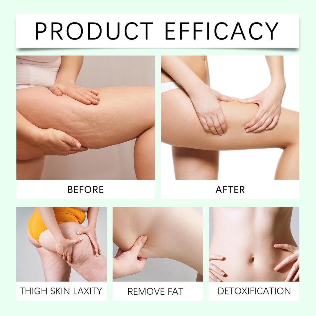 Herbal Body Health Soothing Cream, Relieving Body Care Cream Mild Nourishing Repairing Topical Cream