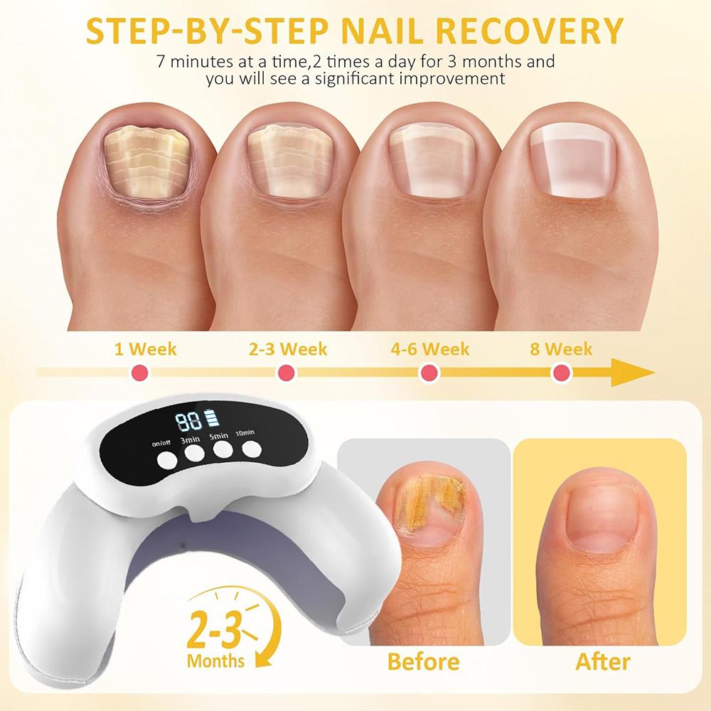 Nail Fungus Cleaning Laser Device For Multiple Toenail Repair Fast Nails Fungus Onychomycosis Removes Ingrown Toenail Treatment