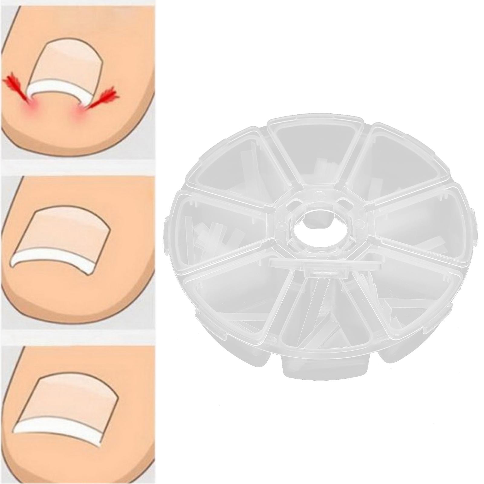 

Вросший ноготь на ноге Корректор Полоски Паронихия Выпрямляющие пятна Ногти Коррекционная палочка