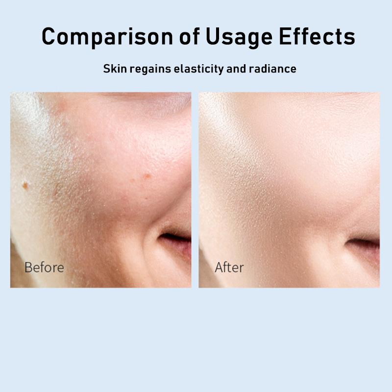 MERCILEN Wasser und Öl Double Lock Straffendes Schönheitsmasken-Set, 5-teilig, feuchtigkeitsspendende, aufhellende Anti-Falten-Ölmaske