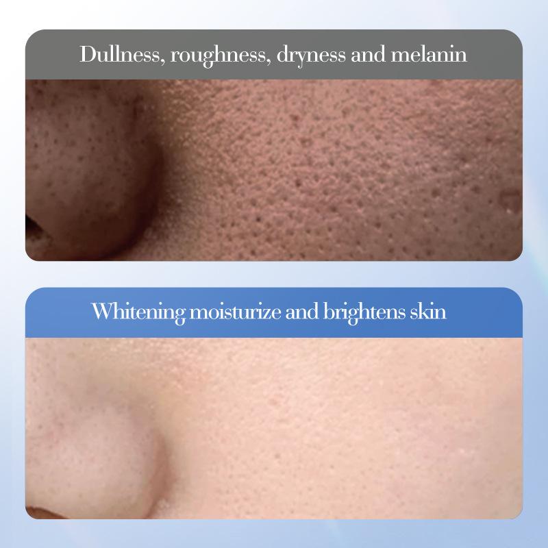 SADOER Brightening, Lifting and Moisturizing Essence White Rice Niacinamide Serum