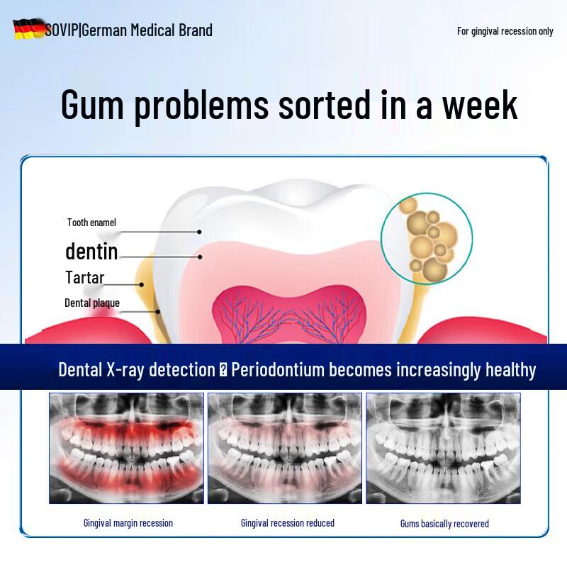 Pastă de dinți SOVIP pentru repararea gingiilor și desensibilizare