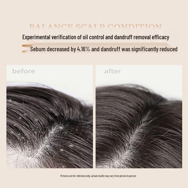 Seeyoung Tea Seed Oil Control Anti-Dandruff Shampoo