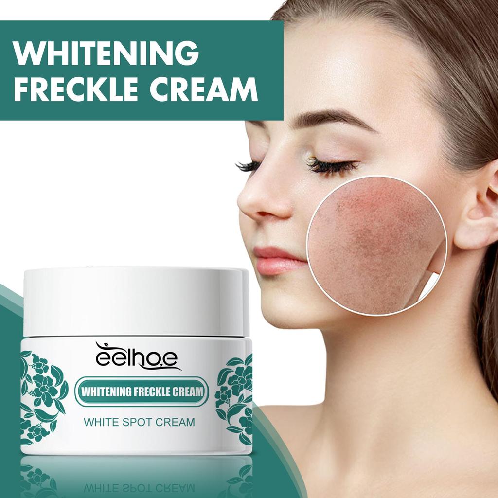 EELHOE Nicotinamid-Sommersprossencreme, feuchtigkeitsspendende Gesichtsaufhellungsreparatur, Hautpflege, Melasma-Entferner, Pigmententfernungscreme, 30 g