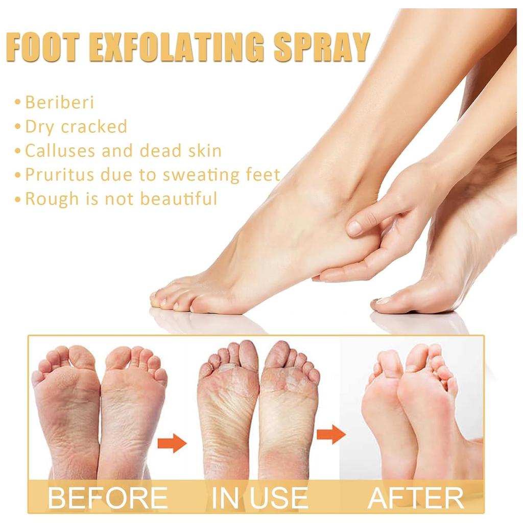 Foot Peeling Spray for Dry Cracked Feet,Instant Exfoliating Foot Spray with Orange Oil,Gentle Foot Peel Mask for Dead Skin Removal Nourishing