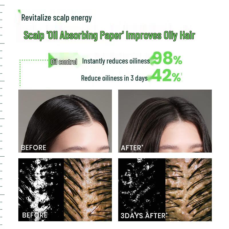 RENE FURTERER Hair Growth & Oil Control Shampoo Duo Set