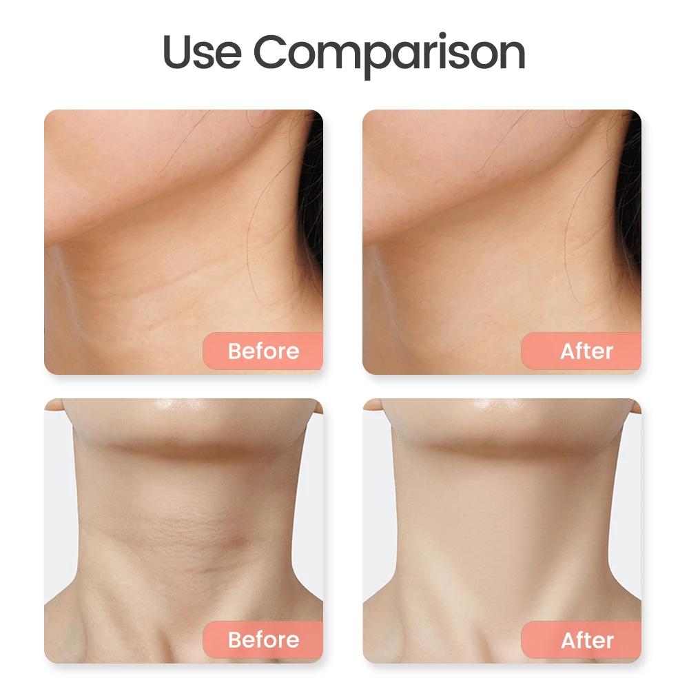 Electric Volcanic Hot Stone Massage Gua Sha Natural Bian Stone Back Neck Face Massager Spa Care Lifting Skin Remove Wrinkles